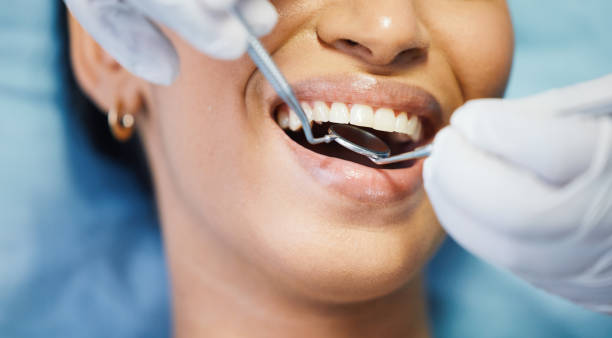 Best Emergency Wisdom Tooth Extraction in Oakland, MD