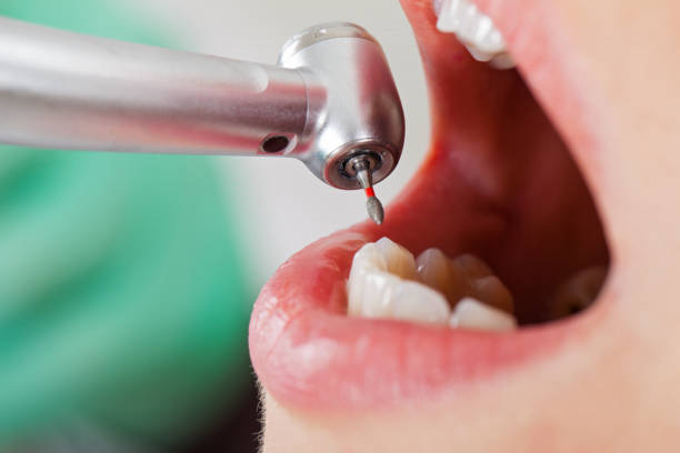 Best Emergency Care for Gum Disease in Oakland, MD